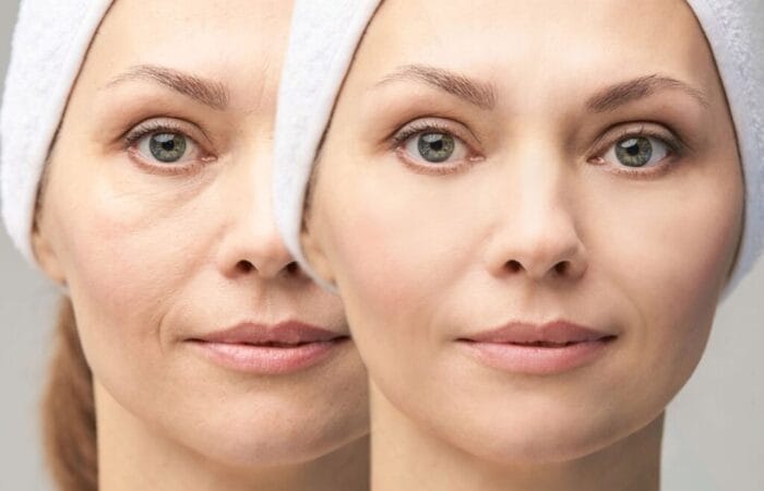 Understanding Pigmentation and how to treat it