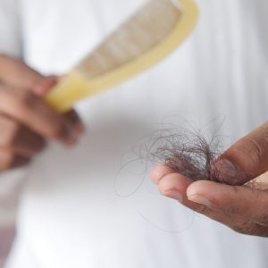 hair loss-Jennifer Carly Aesthetic Medicine