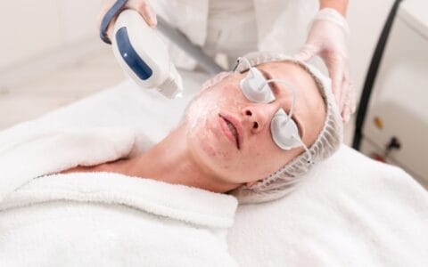 What is Lumecca IPL Treatment?