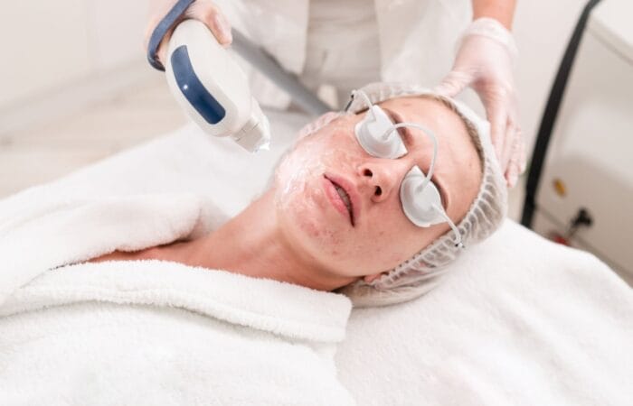 What is Lumecca IPL Treatment?
