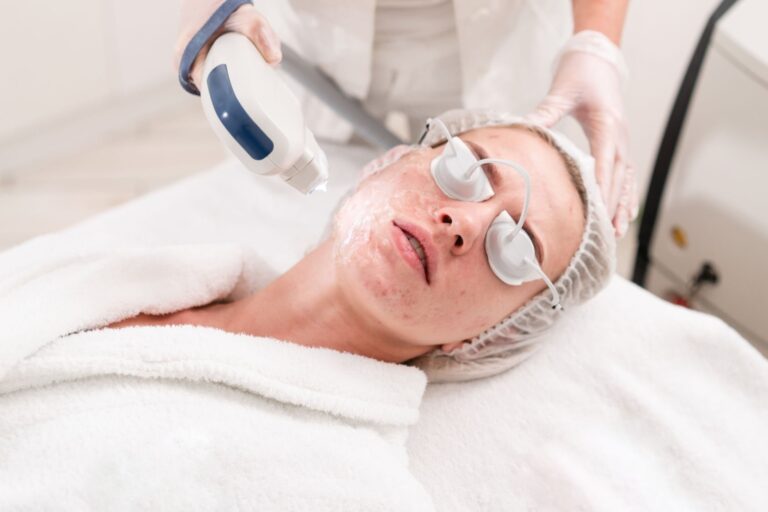 Lumecca IPL Treatment: what you need to know about treating pigmentation and sun damage