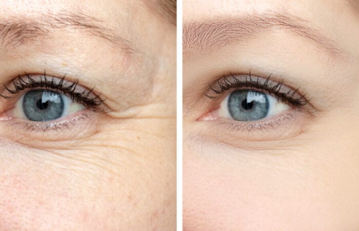 Bio Remodelling, Gawler, Adelaide