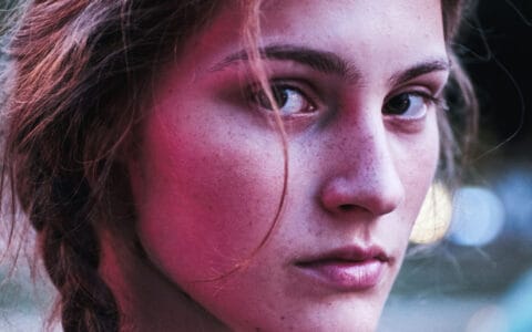 Why is prp better under eyes