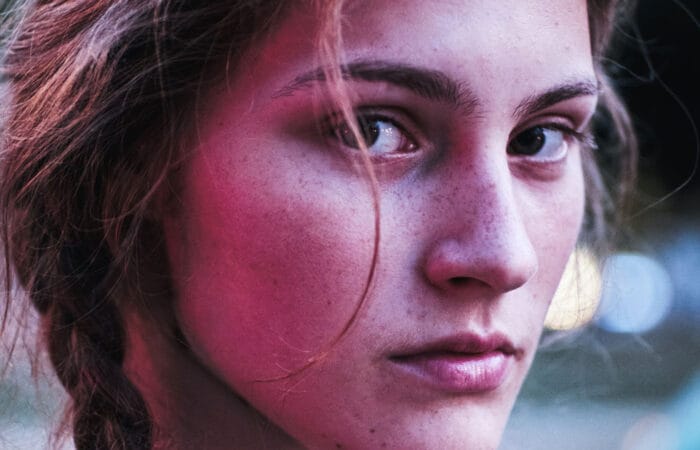 Why is prp better under eyes