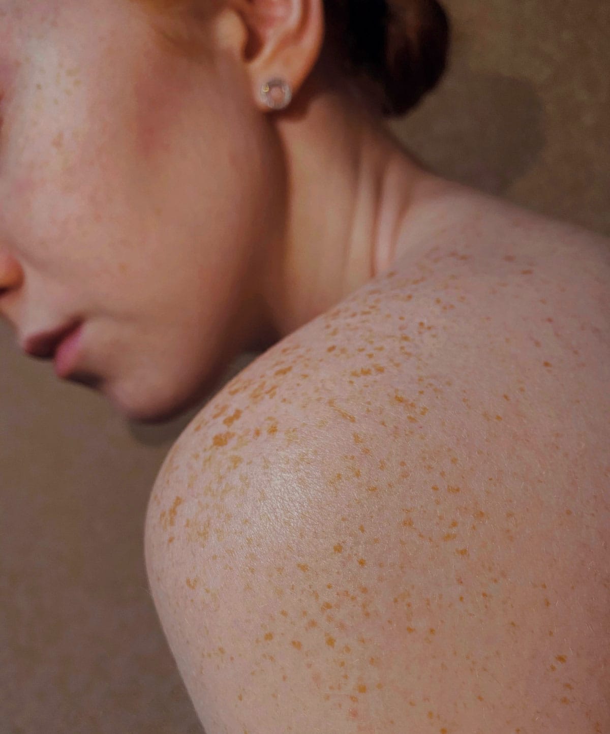 Skin Micro Needling for Wrinkles