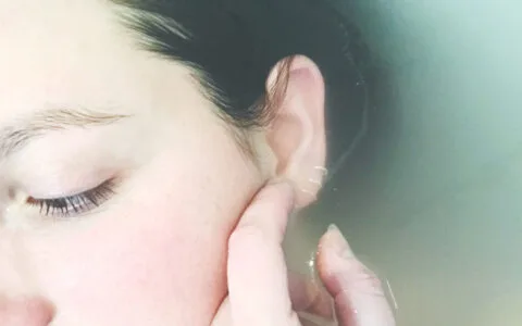 Skin Treatments