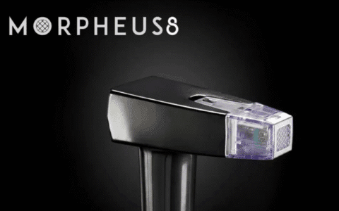 What is Morpheus8 Treatment?