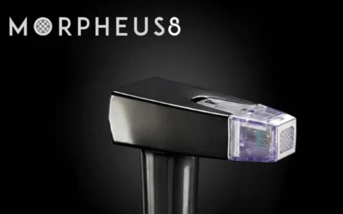 What is Morpheus8 Treatment?