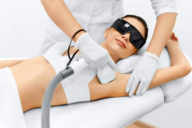 alma laser hair removal