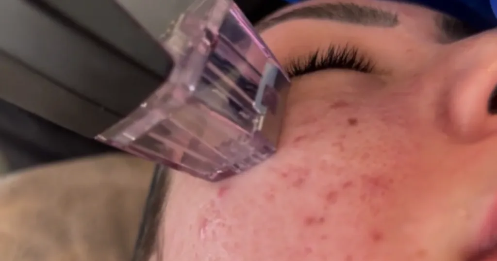 Anti-aging Skin Treatment Solutions in Adelaide and Gawler