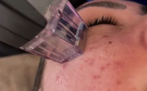Anti-aging Skin Treatment Solutions in Adelaide and Gawler