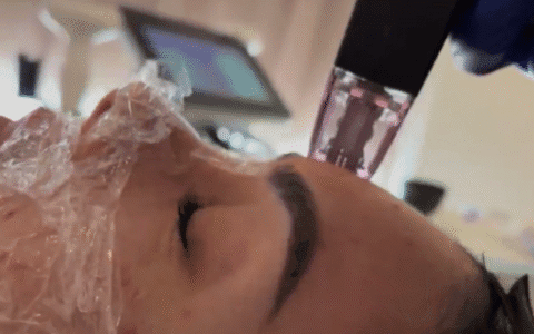 Best Treatment for Skin Care in South Australia