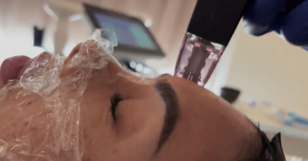 Best Treatment for Skin Care in South Australia