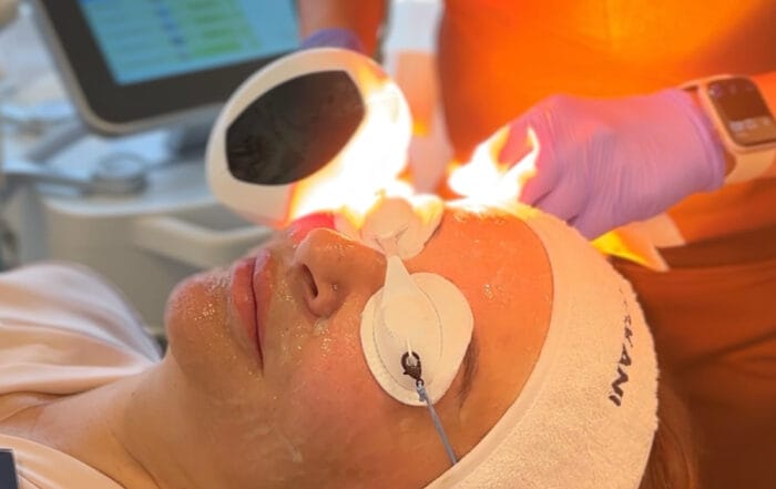 How many Skin layers are there