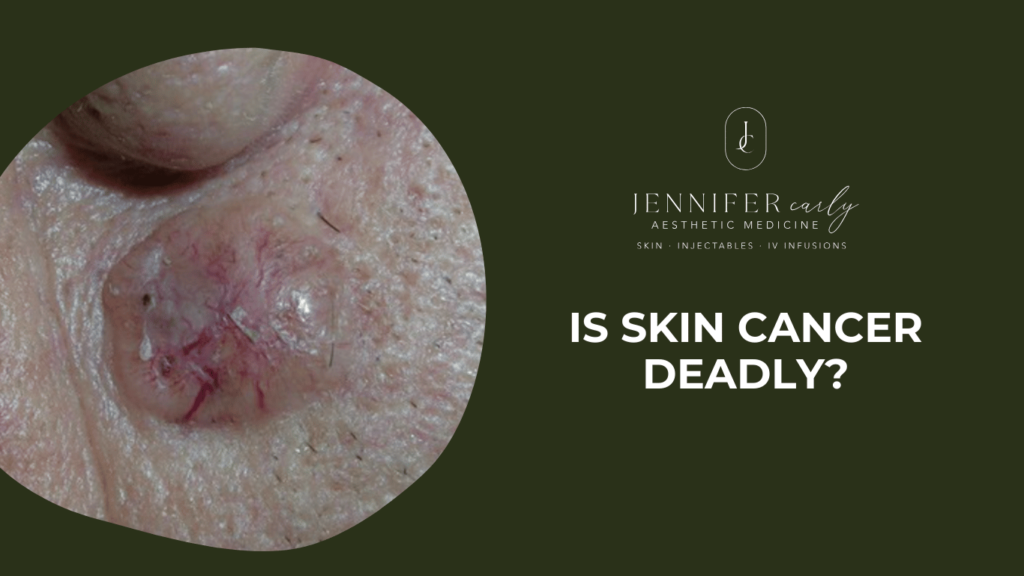 Is Skin Cancer Deadly?