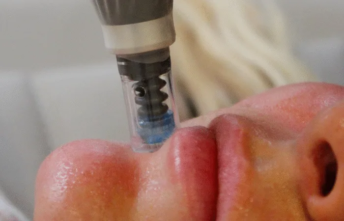Is Skin Cancer Deadly