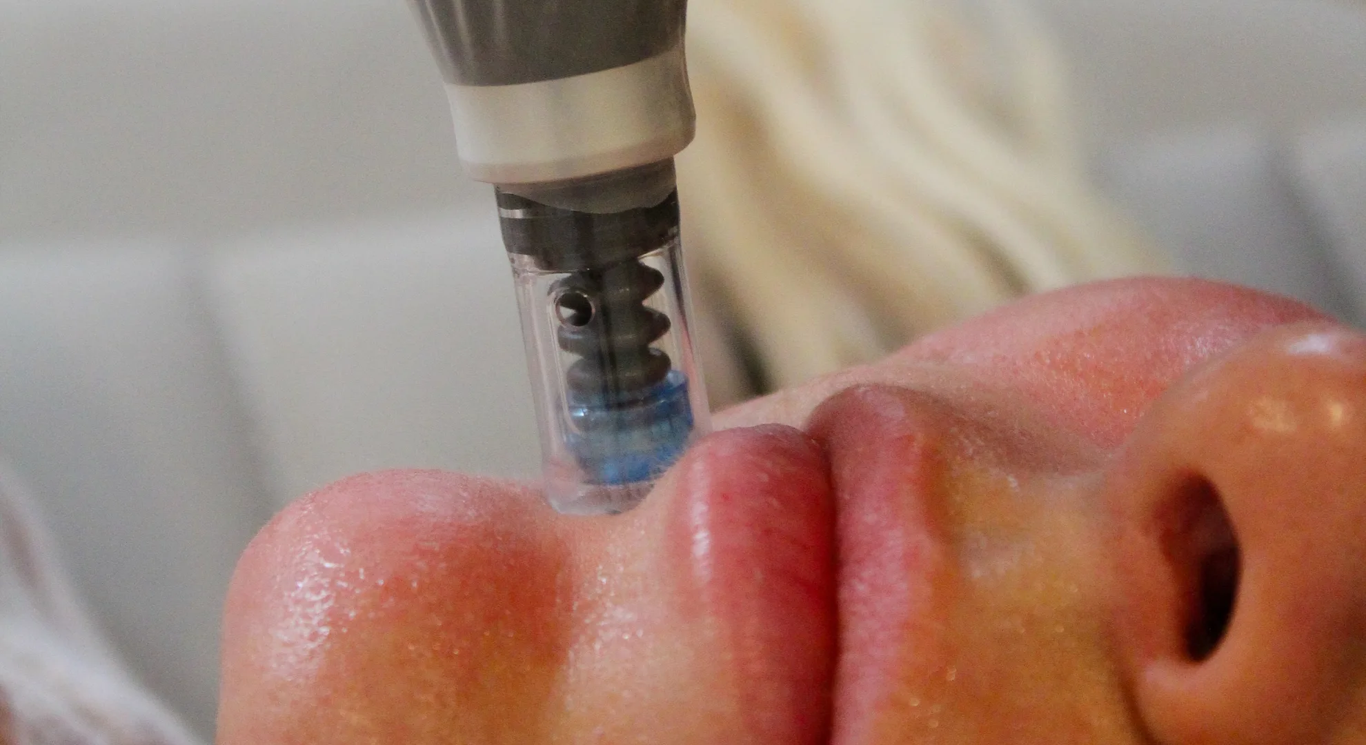 Is Skin Cancer Deadly
