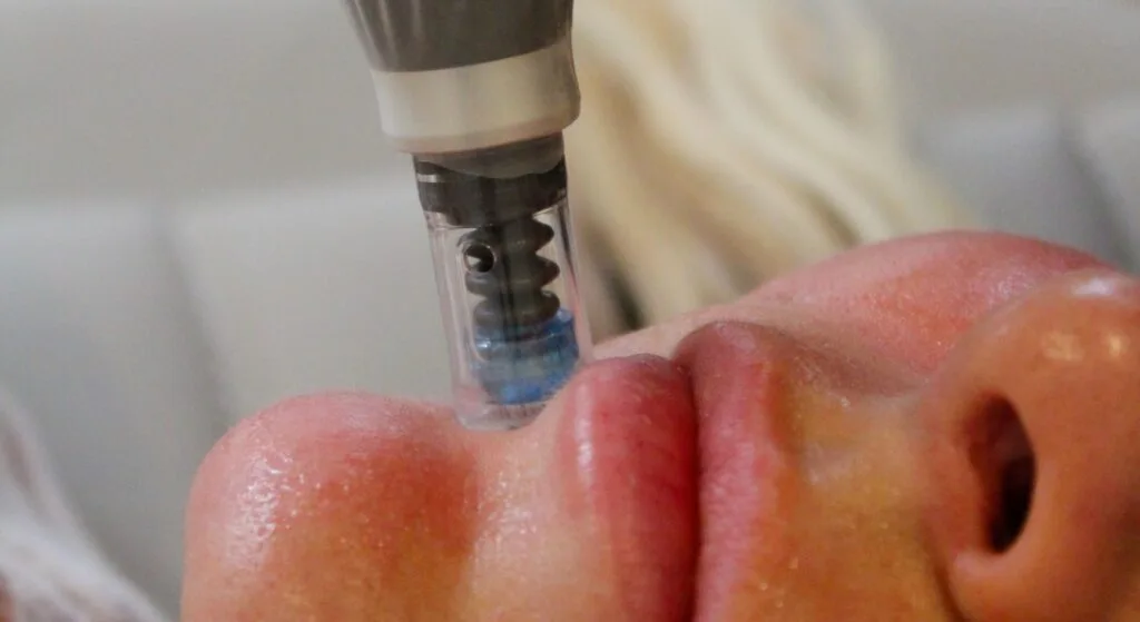 Why Skin Care in South Australia Requires Special Attention