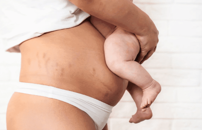 What Pregnant and Postpartum Women in Gawler and Adelaide Should Know