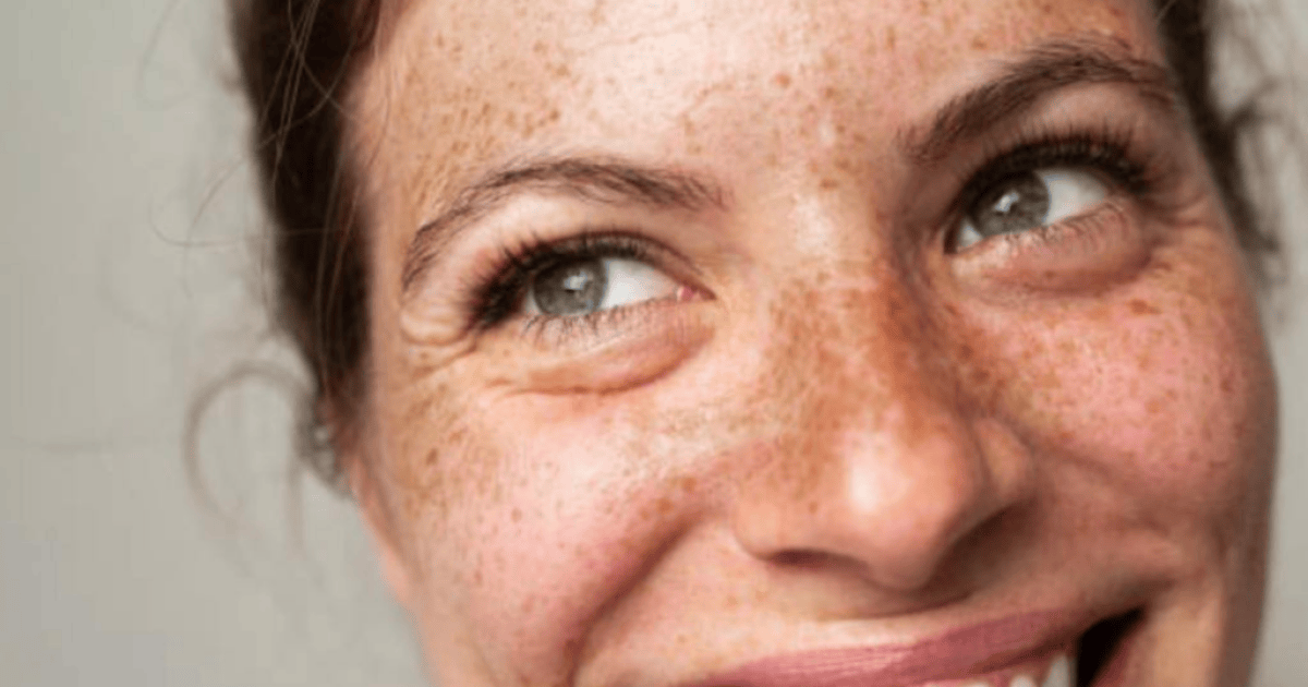 What Causes Your Skin to Darken?