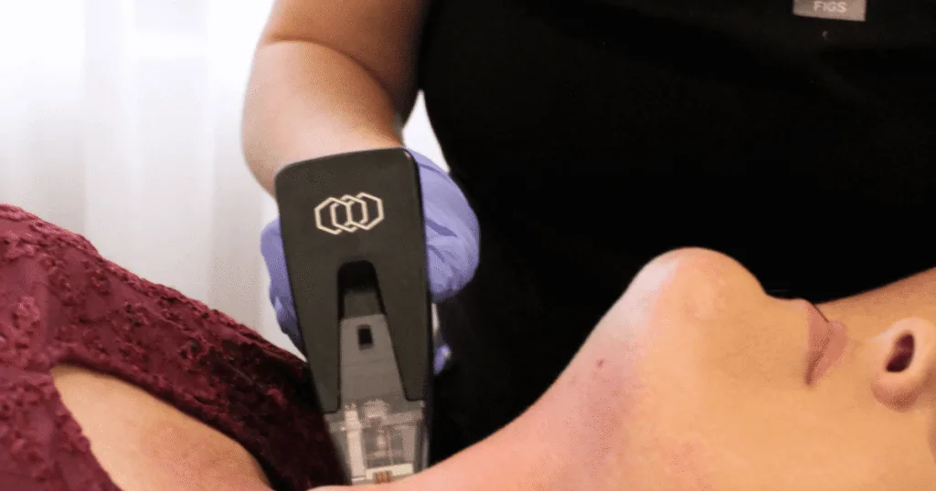 Morpheus8 Treatment in Australia