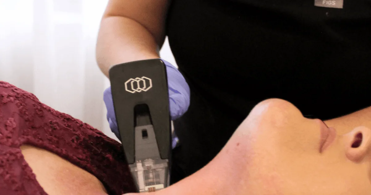 Morpheus8 Treatment in Australia
